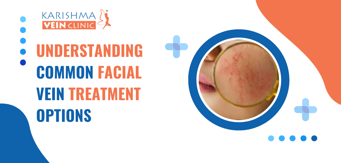 Understanding-Common-Facial-Vein-Treatment-Options