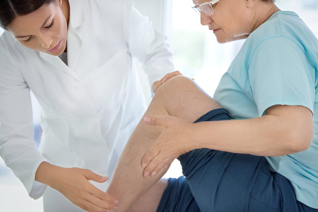 How To Treat Reticular Veins