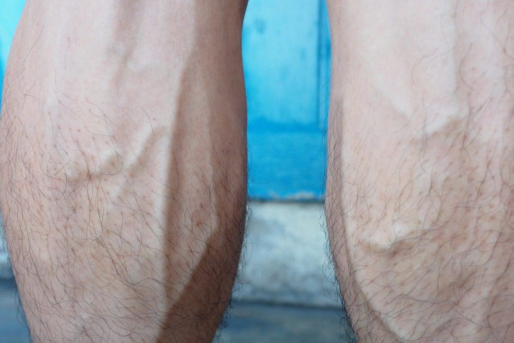 Veins Popping Out