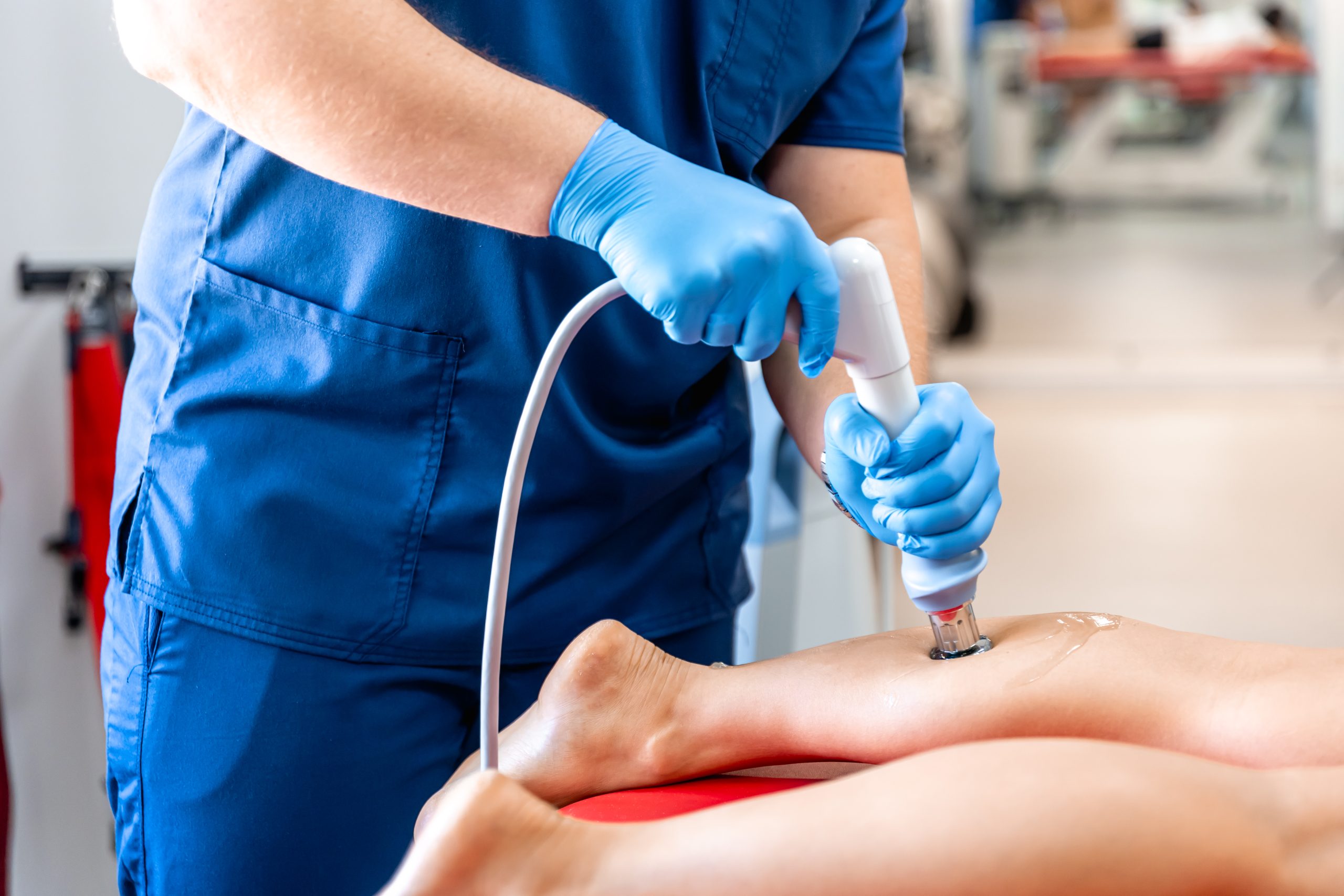 Latest Treatment for Varicose Veins: Advances You Should Know