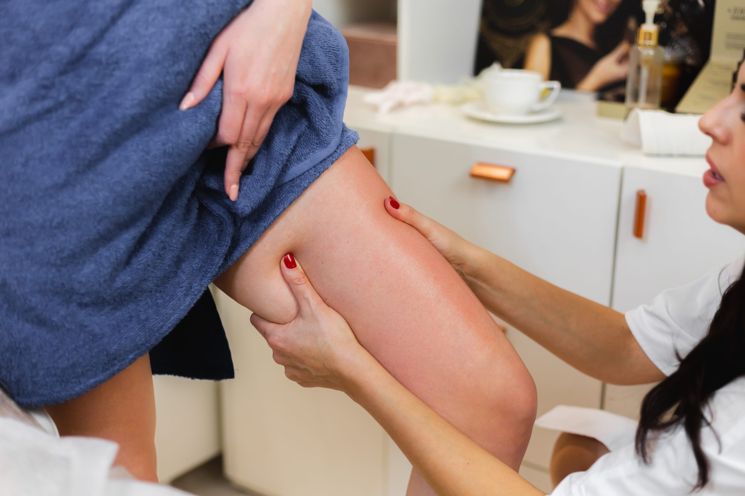 Sclerotherapy After 1 Week: What to Expect