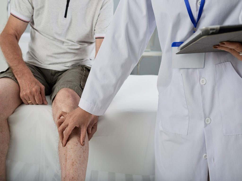 When Should You See a Varicose Veins Doctor - 10 Signs You Shouldn’t Ignore